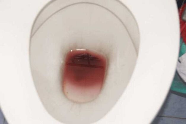 hayajonlanganda erkaklarda dog'lanish